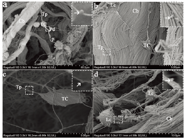 TP LE MICROMETRE